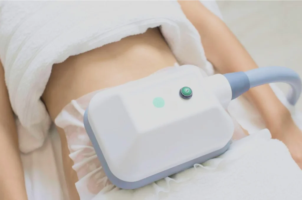 How Fat Freezing and HIFU Work Together? 3 advantages to combining Fat Freezing and HIFU Wales