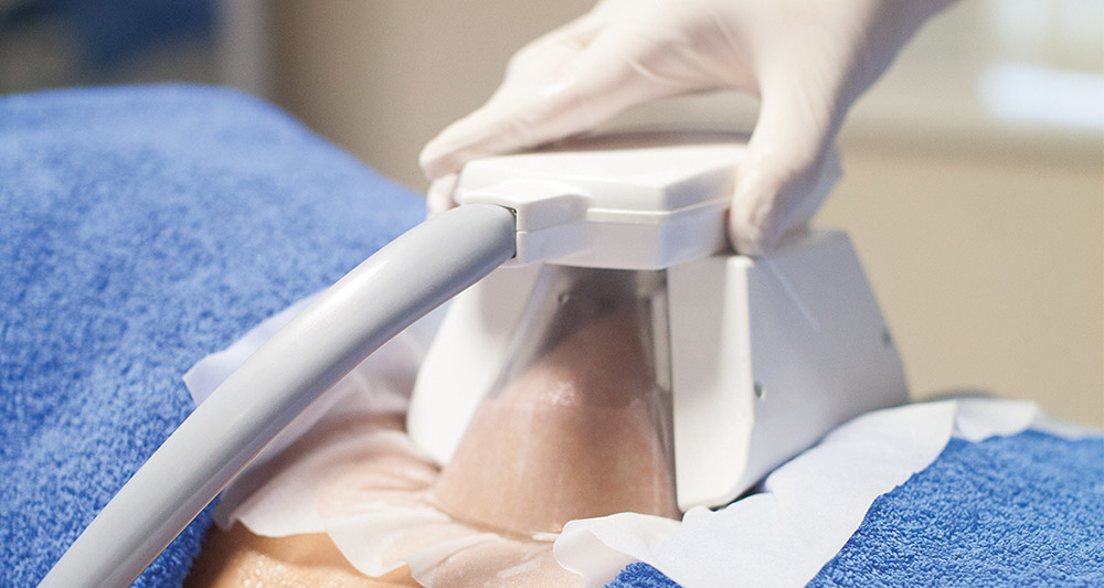 How Fat Freezing and HIFU Work Together? 2 Multiple Areas in One Session HIFU and Fat Freezing Wales