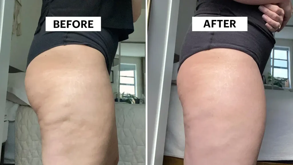 Do Toning Exercise Wales Really Tackle Cellulite?