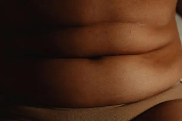 The Hidden Connection: How Stress Shapes Your Fitness and Body Composition 3 image of what stress can do on the stomach area and how Lipo 360 Wales can help to change your body shape.