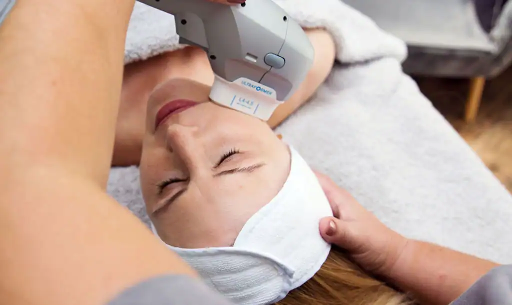 Discover the Perfect Duo: Morpheus8 and HIFU 1 Image of Morpheus8 And HIFU Wales combined treatment